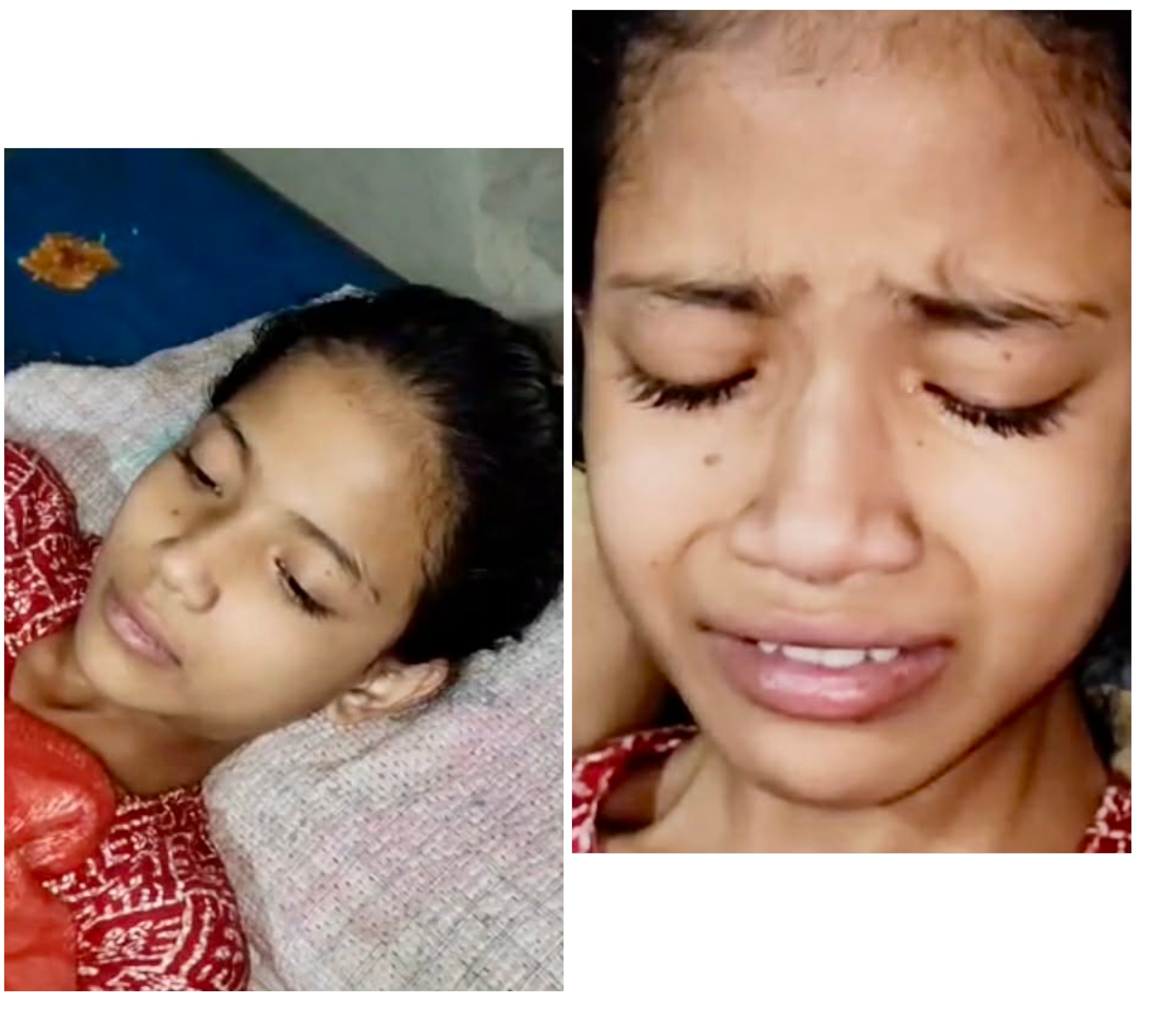 ক্যান্সারের সঙ্গে লড়ছে সিংড়ার ছোট্ট মাসুমা সে বাঁচতে চায়